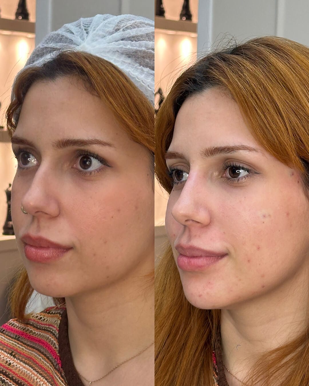 10A64E9E-E954-4D22-803C-1AAEB8F892D6 1