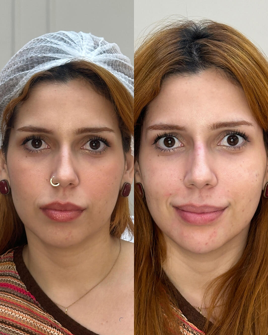 441271D6-F1C9-410E-A936-48D2AFB682B8 1