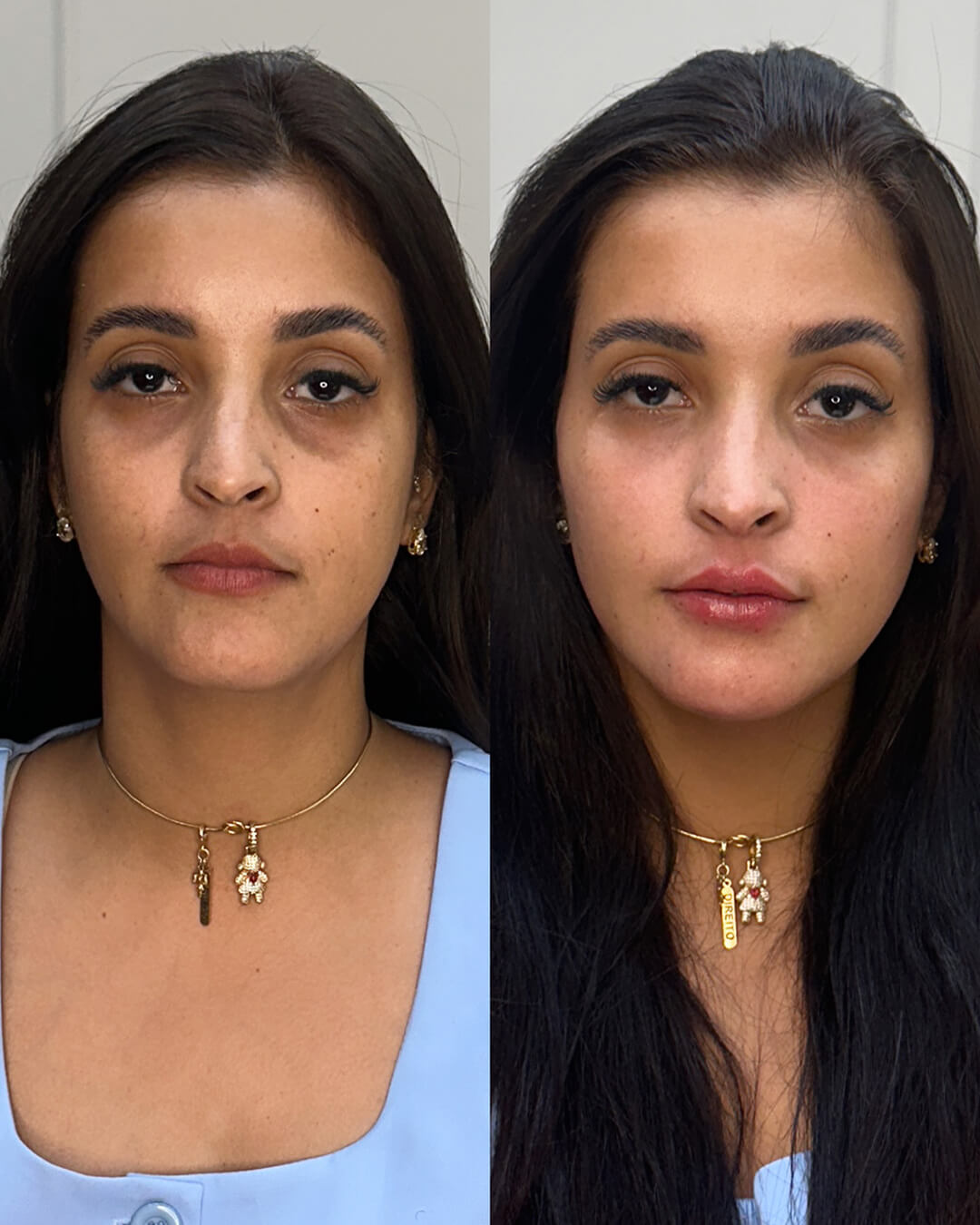 A18B8DF0-33D3-414A-9107-38357CEF53E6 1