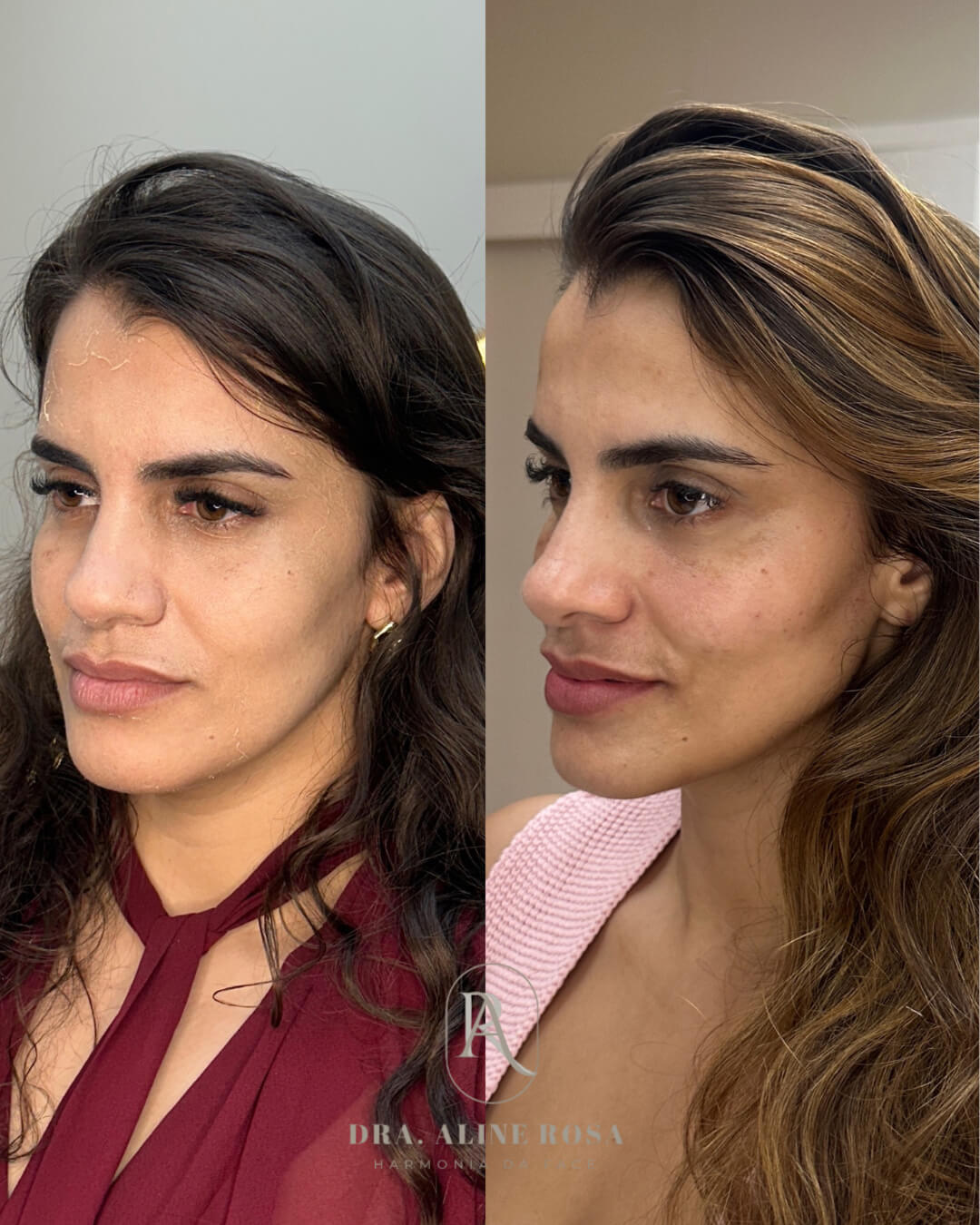 Design sem nome(1) 1