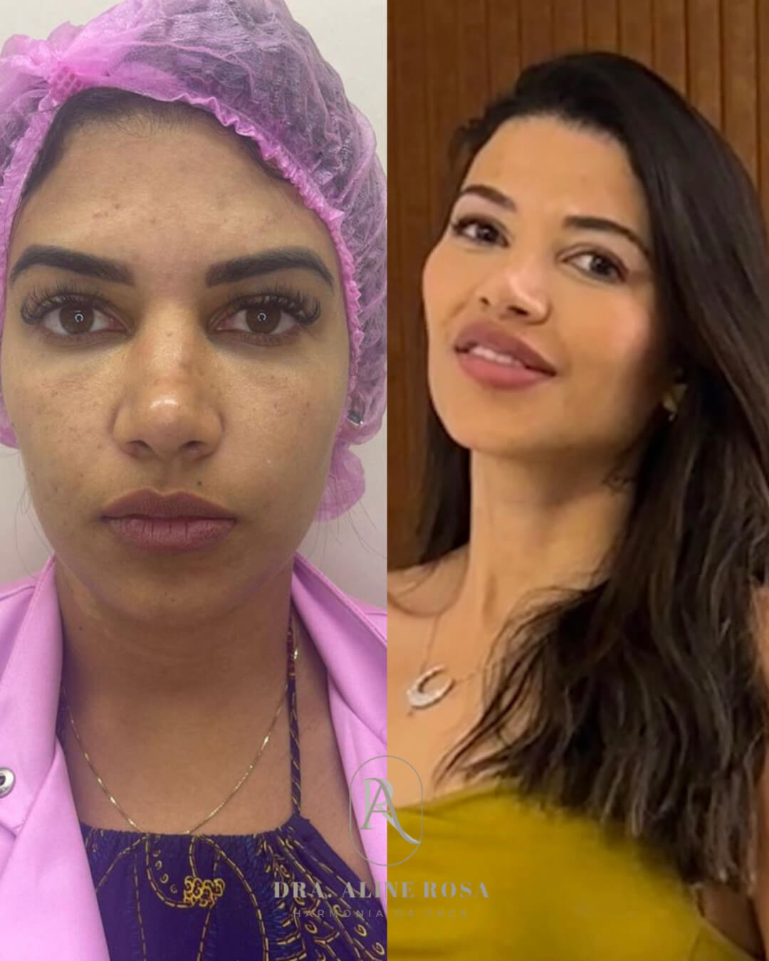 Design sem nome(2) 1